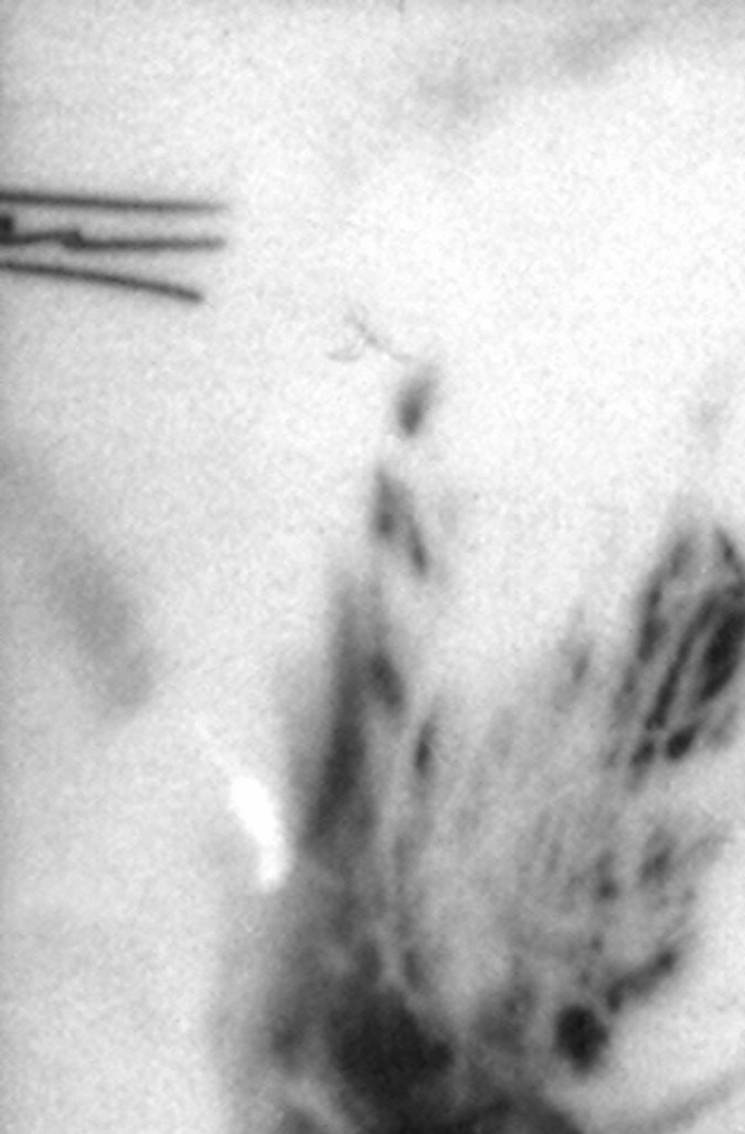 Rocío Dúrcal en 1963 | Foto: Mezcalent