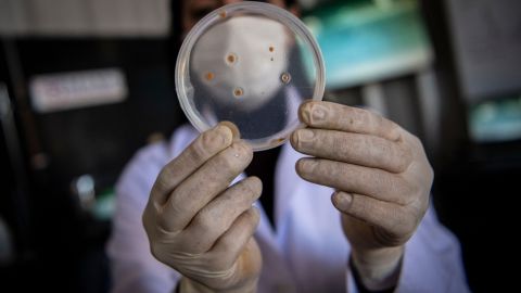 Científicos advierten que casos de bacterias carnívoras podrían aumentar y ocurrir en más lugares por cambio climático