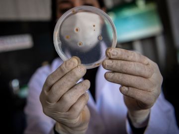 Científicos advierten que casos de bacterias carnívoras podrían aumentar y ocurrir en más lugares por cambio climático