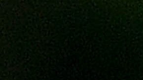 El jugador terminó con varias fracturas.