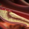 H5N1 Bird Flu Detected in Texas Dairy Cattle