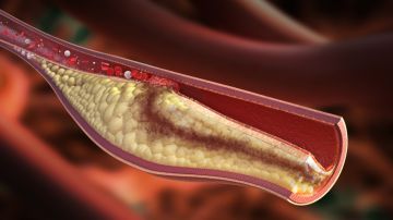 Arterias tapadas: alimentos simples que pueden mejorar la circulación