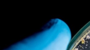 Por qué las bacterias se vuelven resistentes a los antibióticos: todo lo que debemos saber