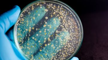 Por qué las bacterias se vuelven resistentes a los antibióticos: todo lo que debemos saber