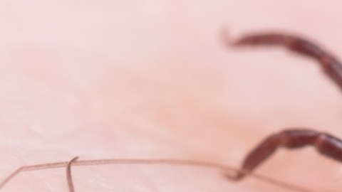 Qué es la babesiosis, la nueva enfermedad que está en aumento al noreste de EE. UU.