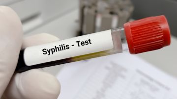 CDH declara brote de sífilis en cuatro condados de Estados Unidos
