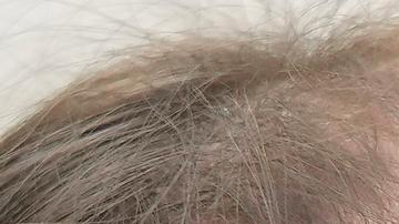 OPS advierte de brotes de enfermedades en América por falta de vacunación