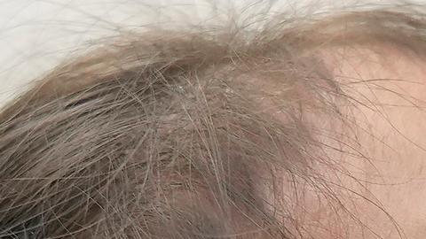 OPS advierte de brotes de enfermedades en América por falta de vacunación