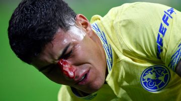 Alejandro Zendejas sangrando tras un choque con el Club América.