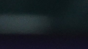 Josh Smith recibe pelotazo en el rostro.