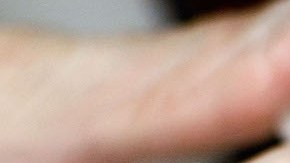 El estudio descubrió que el botox obstaculizaba la "hipótesis de retroalimentación facial". / Foto: Getty Images