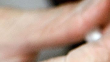 El estudio descubrió que el botox obstaculizaba la "hipótesis de retroalimentación facial". / Foto: Getty Images