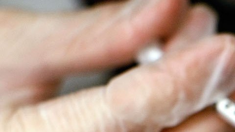 El estudio descubrió que el botox obstaculizaba la "hipótesis de retroalimentación facial". / Foto: Getty Images