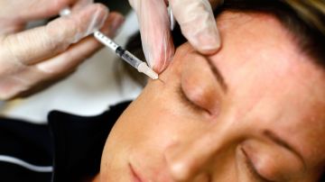 El estudio descubrió que el botox obstaculizaba la "hipótesis de retroalimentación facial". / Foto: Getty Images