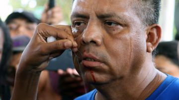 Migrantes en caravana se cosen los labios para presionar al gobierno de México
