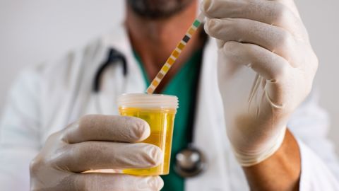 Qué causa las infecciones urinarias y cómo prevenirlas