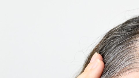 Por qué el cabello se pone blanco y qué están haciendo los científicos para revertirlo