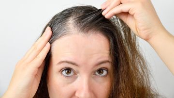 Por qué el cabello se pone blanco y qué están haciendo los científicos para revertirlo