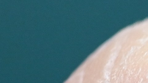 Vacuna de ARN muestra resultados prometedores contra el cáncer de páncreas agresivo