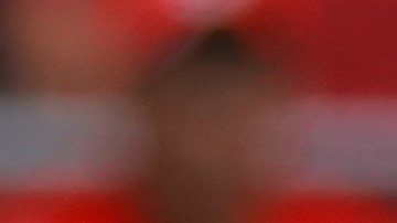 Choque de Nahuel Guzmán en el partido de Toluca.