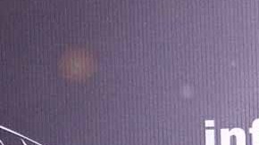 Una bacteria afectó severamente el rostro de Merle Uribe