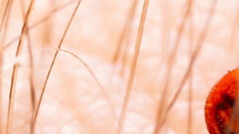 Virus Powassan: cómo protegerte de la mortal enfermedad transmitida por garrapatas