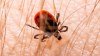 Virus Powassan: cómo protegerte de la mortal enfermedad transmitida por garrapatas