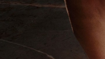 Cada vez más niños y adolescentes se someten a cirugías para bajar de peso en EE. UU.