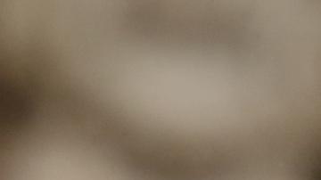 Papa Francisco será operado de urgencia