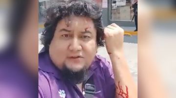 Ataque a periodista mexicano