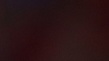 El portero sufrió una lesión en la Premier League.