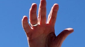 Papa Francisco es operado de la hernia abdominal “sin complicaciones”, informa el Vaticano