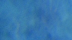 Mujer de 73 años sufre ataque de un tiburón que narró como una película de terror y le amputan una pierna