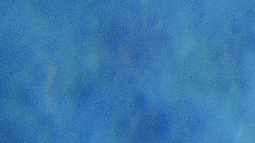 Mujer de 73 años sufre ataque de un tiburón que narró como una película de terror y le amputan una pierna