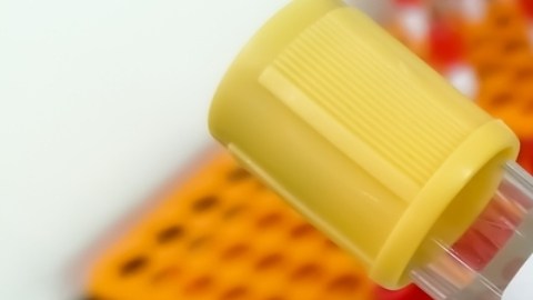 Metapneumovirus: todo lo que debes conocer sobre esta infección respiratoria