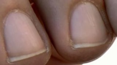 El captagón, apodado "la cocaína de los pobres", se produce en cantidades masivas en Siria.