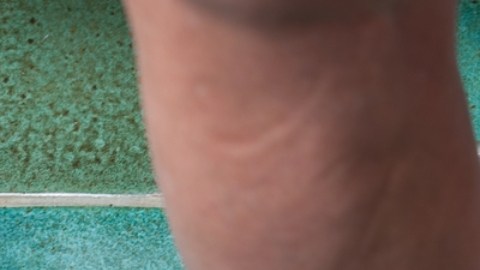 Científicos trabajan en una píldora para la obesidad que funcione como Ozempic
