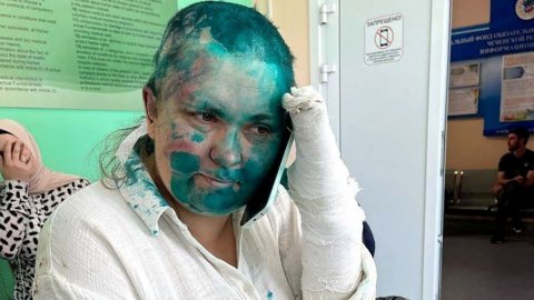 El brutal ataque a la periodista rusa responsable de destapar torturas y asesinatos de personas LGBT en Chechenia