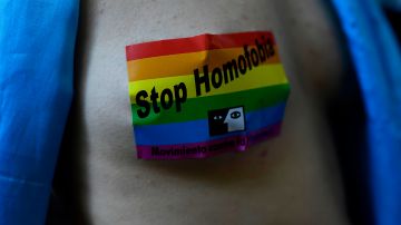 A member of the Lesbian, Gay, Bisexual, Transgender, Intersex and Queer (LGBTIQ) community wears a sticker on his chest reading "Stop Homophobia" during the annual Pride parade in Madrid, on July 6, 2019. (Photo by OSCAR DEL POZO / AFP) (Photo credit should read OSCAR DEL POZO/AFP via Getty Images)