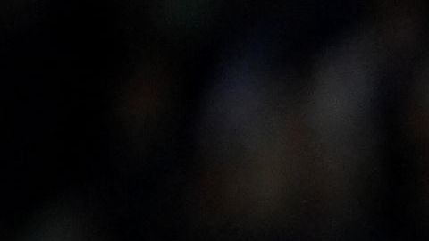 Una jugadora de Irlanda salió lesionada en los primeros 20 minutos.
