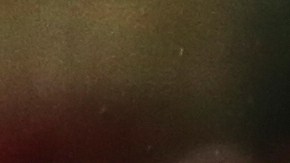 Silva deberá retirarse abruptamente por la rotura de ligamentos.