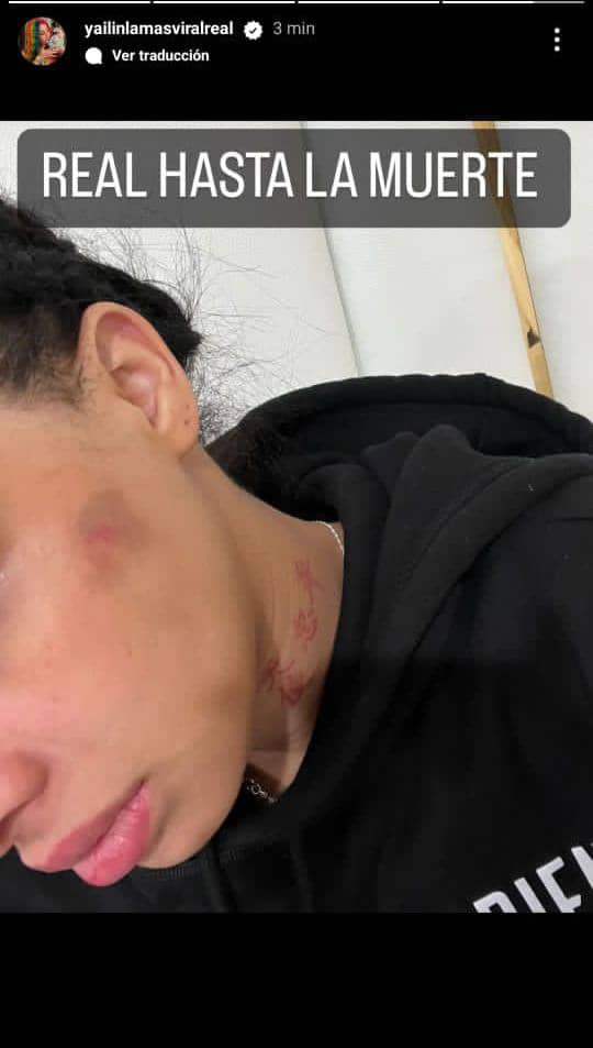 En medio de la tángana que se armó entre Anuel AA y Tekashi 6ix9ine, Yailin 'La Más Viral' decidió acusar a su ex de haberla maltratado en su embarazo y hasta de haberla "robado