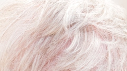 Leqembi es el primer medicamento aprobado por la FDA para tratar Alzheimer: de qué se trata