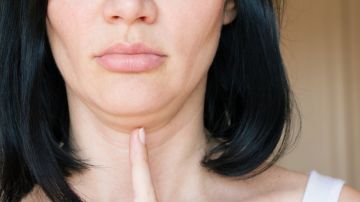 Cómo reafirmar la piel del rostro después de perder mucho peso