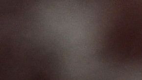 México en alerta tras reporte de más de 300 casos de lepra; vigila 12 municipios por alto número de pacientes