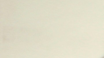 LOS ANGELES, CA - JULY 10: Pablo Suares has his blood pressure checked as nurses and physicians give free basic health screenings and call attention to what they say is the ongoing healthcare emergency despite the decision of the U.S. Supreme Court to uphold the Affordable Care Act, on July 10, 2012 in Los Angeles, California. Three days of free screenings in the Los Angeles area are part of the Medicare for All tour which is making up to two dozen stops across California between June 19 and July 12. The California Nurses Association says that 30 percent of Los Angeles County adults are uninsured and 18 percent cannot afford doctor visits. (Photo by David McNew/Getty Images)