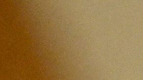 Hombre con parálisis se comunica gracias a implante cerebral