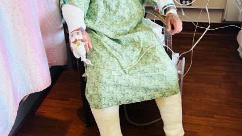 Leonel Martínez, padre de tres hijos sufre severo accidente mientras laboraba. (Cortesía)