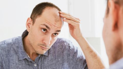 Estados Unidos es el octavo país con más hombres calvos en el mundo: cómo prevenirlo