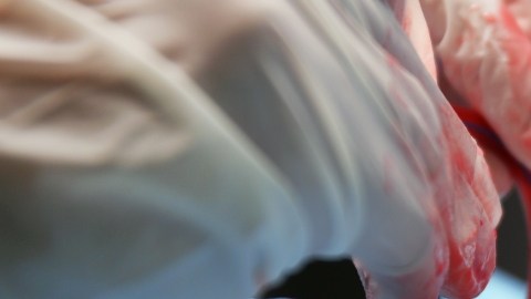 Hallaron restos de microplásticos en corazones humanos por primera vez